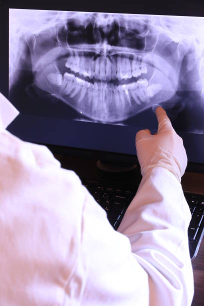 Best Emergency Dentist for Special Needs Patients in Lakeport, CA