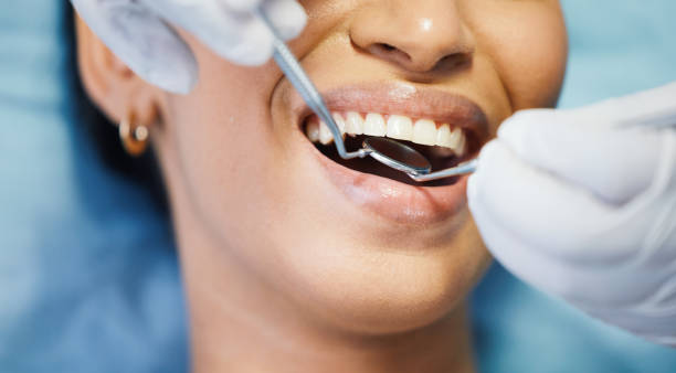 Best Emergency Dental Extractions in Lakeport, CA